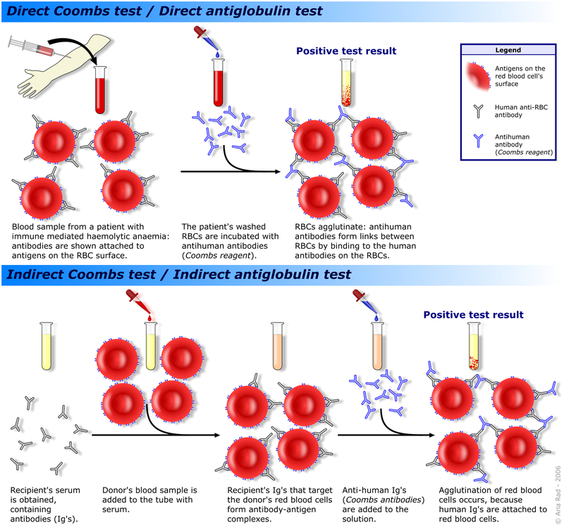 https://upload.wikimedia.org/wikipedia/commons/thumb/1/1c/Coombs_test_schematic.png/800px-Coombs_test_schematic.png